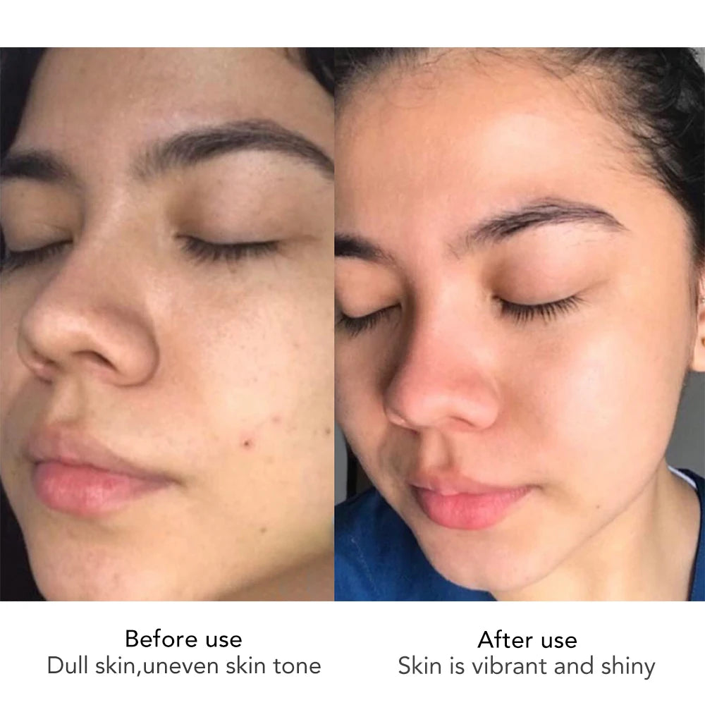 AILKE Korean Anti-aging Cream With Hyaluron Scars Whitening Moisturizing Lifting Anti-aging Women